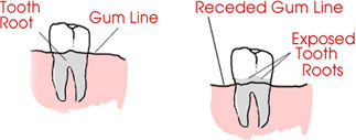 What causes nerve pain in teeth?