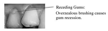 gum disease